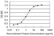 Anti-PDCL3 Antibody
