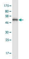 Anti-PDCL3 Antibody