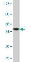 Anti-PDE4C Antibody
