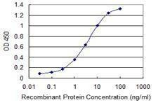 Anti-PDE4DIP Antibody