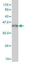 Anti-PDE5A Antibody