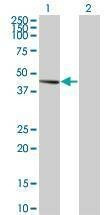 Anti-PDK2 Antibody
