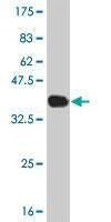 Anti-PDK3 Antibody