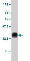 Anti-PET112L Antibody