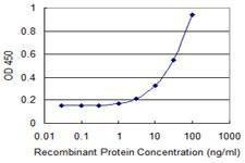 Anti-PFDN2 Antibody