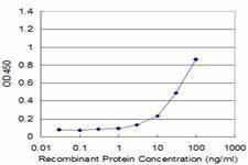 Anti-PGK1 Antibody