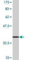 Anti-PHACTR2 Antibody