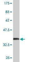 Anti-PHF7 Antibody