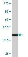 Anti-PIAS1 Antibody