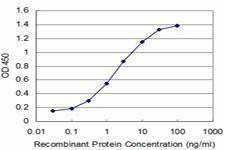 Anti-PIAS1 Antibody