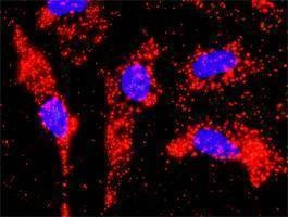 Anti-PIAS1 Antibody
