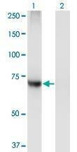 Anti-PIGQ Antibody
