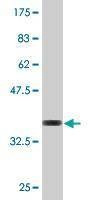 Anti-PIGQ Antibody
