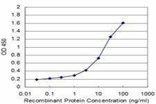 Anti-PIGQ Antibody