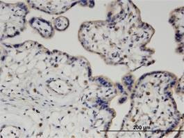 Anti-PIGQ Antibody