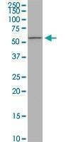 Anti-PIGW Antibody