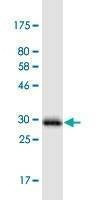 Anti-PIGW Antibody