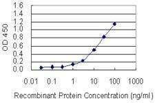 Anti-PIGW Antibody