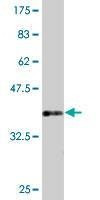 Anti-PIK3CB Antibody