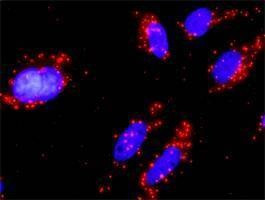 Anti-PIK3CB Antibody