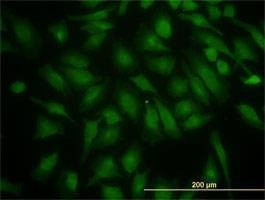 Anti-PIK3R4 Antibody