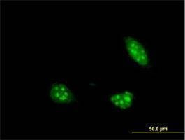 Anti-PIM1 Antibody