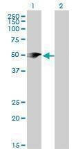 Anti-PIP4K2A Antibody