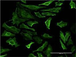 Anti-PIP4K2A Antibody