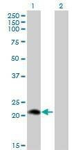 Anti-PLA2G12A Antibody