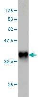 Anti-PLA2G12A Antibody