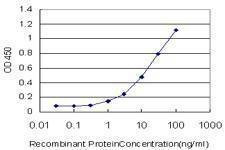 Anti-PLA2G12A Antibody