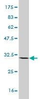 Anti-PLA2G1B Antibody