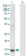 Anti-PLA2G1B Antibody