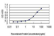 Anti-PLA2G4A Antibody