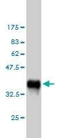 Anti-PLCG1 Antibody
