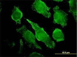 Anti-PLCG1 Antibody