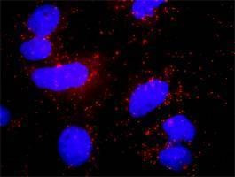 Anti-PLCG1 Antibody