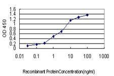 Anti-PLCG1 Antibody