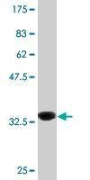Anti-PLCL2 Antibody