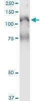 Anti-PLCL2 Antibody