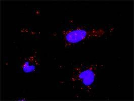 Anti-PML Antibody