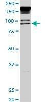 Anti-PML Antibody