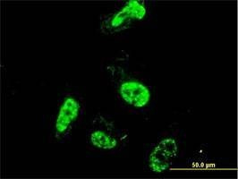 Anti-PML Antibody