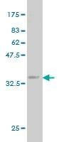 Anti-PMM2 Antibody