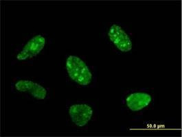 Anti-POLR1C Antibody