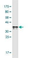 Anti-POLRMT Antibody
