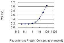 Anti-POLRMT Antibody