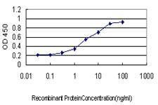 Anti-POLS Antibody
