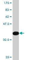 Anti-PON1 Antibody