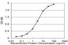 Anti-PON1 Antibody